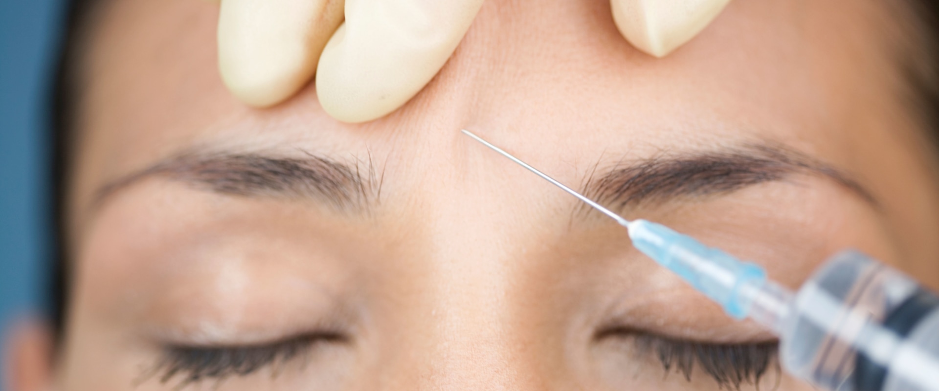 How Much Does Botox Cost? A Comprehensive Guide