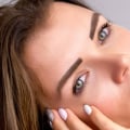 Can Botox Injections Kill You?