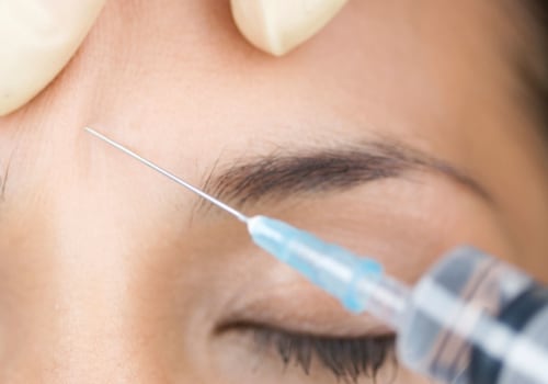How Much Does Botox Cost? A Comprehensive Guide